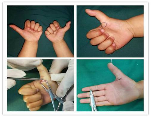 clip_image002.jpg 1dbc0003924c492298a2